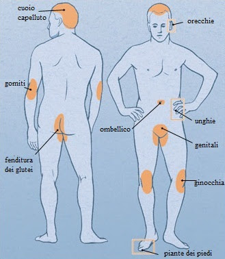 Psoriasi. Le aree cutanee più colpite.jpg